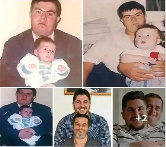 Father With Down Syndrome Raises Son Who Goes on to Become a Doctor - featured image Father With Down Syndrome Raises Son Who Goes on to Become a Doctor - featured image