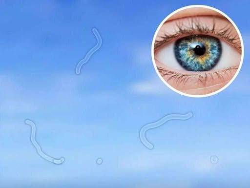 Eye floaters: what they are and what to do if you notice them, according to an eye doctor Eye floaters: what they are and what to do if you notice them, according to an eye doctor - featured image