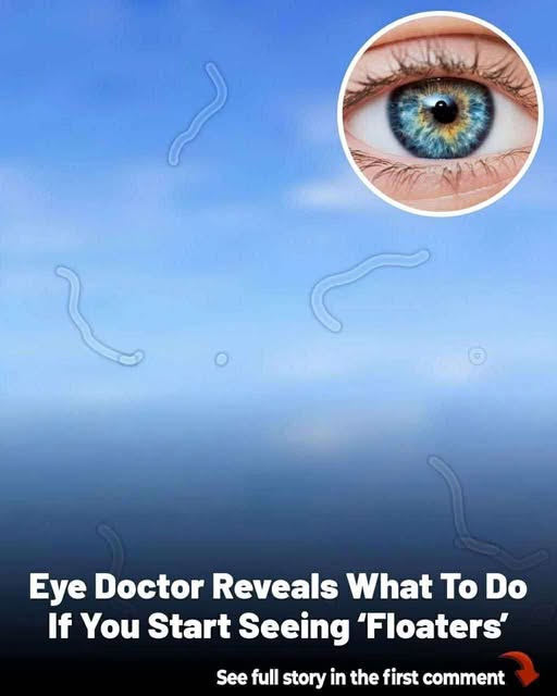 Eye floaters: what they are and what to do if you notice them, according to an eye doctor - featured image Eye floaters: what they are and what to do if you notice them, according to an eye doctor - featured image