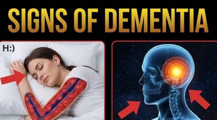 10 Signs of Dementia You Should Never Ignore 10 Signs of Dementia You Should Never Ignore - featured image