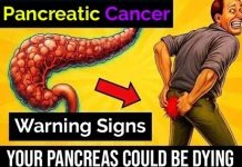 Warning Signs of Pancreatic Cancer You Should Never Ignore Warning Signs of Pancreatic Cancer You Should Never Ignore - featured image
