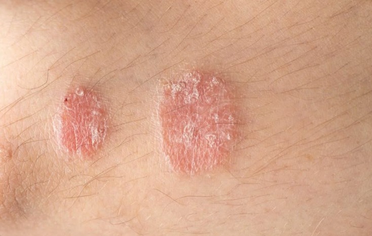 If you notice these signs on your body, consult a doctor immediately - featured image If you notice these signs on your body, consult a doctor immediately - featured image