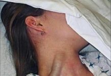 SENSATIONAL TRAGEDY Young Woman Loss Sparks Massive Global Conversation On Hidden Health Dangers SENSATIONAL TRAGEDY Young Woman Loss Sparks Massive Global Conversation On Hidden Health Dangers - featured image