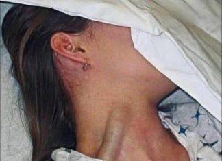 SENSATIONAL TRAGEDY Young Woman Loss Sparks Massive Global Conversation On Hidden Health Dangers SENSATIONAL TRAGEDY Young Woman Loss Sparks Massive Global Conversation On Hidden Health Dangers - featured image
