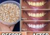 Eggshells Transform Yellow Teeth to Pearl White in Just 5 Minutes Eggshells Transform Yellow Teeth to Pearl White in Just 5 Minutes - featured image