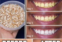 Eggshells Transform Yellow Teeth to Pearl White in Just 5 Minutes Eggshells Transform Yellow Teeth to Pearl White in Just 5 Minutes - featured image