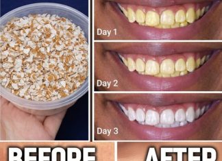Eggshells Transform Yellow Teeth to Pearl White in Just 5 Minutes Eggshells Transform Yellow Teeth to Pearl White in Just 5 Minutes - featured image