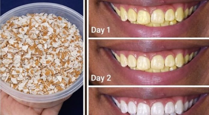 Eggshells Transform Yellow Teeth to Pearl White in Just 5 Minutes Eggshells Transform Yellow Teeth to Pearl White in Just 5 Minutes - featured image