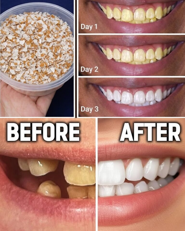 Eggshells Transform Yellow Teeth to Pearl White in Just 5 Minutes - featured image Eggshells Transform Yellow Teeth to Pearl White in Just 5 Minutes - featured image