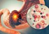 Doctors Reveal the One Blood Type Which Has the Lowest Risk of Ca.ncer Doctors Reveal the One Blood Type Which Has the Lowest Risk of Ca.ncer - featured image
