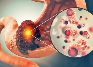 Doctors Reveal the One Blood Type Which Has the Lowest Risk of Ca.ncer Doctors Reveal the One Blood Type Which Has the Lowest Risk of Ca.ncer - featured image