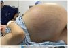 Tears of Joy Turn to Shock: A Pregnant Woman Expecting Triplets Leaves Doctors Stunned by a Terrifying Discovery During C-Section Tears of Joy Turn to Shock: A Pregnant Woman Expecting Triplets Leaves Doctors Stunned by a Terrifying Discovery During C-Section - featured image