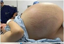 Tears of Joy Turn to Shock: A Pregnant Woman Expecting Triplets Leaves Doctors Stunned by a Terrifying Discovery During C-Section Tears of Joy Turn to Shock: A Pregnant Woman Expecting Triplets Leaves Doctors Stunned by a Terrifying Discovery During C-Section - featured image