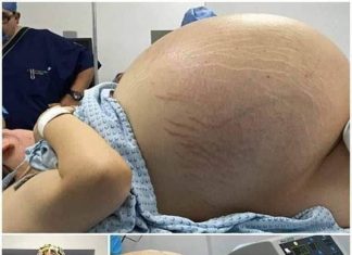 Tears of Joy Turn to Shock: A Pregnant Woman Expecting Triplets Leaves Doctors Stunned by a Terrifying Discovery During C-Section Tears of Joy Turn to Shock: A Pregnant Woman Expecting Triplets Leaves Doctors Stunned by a Terrifying Discovery During C-Section - featured image