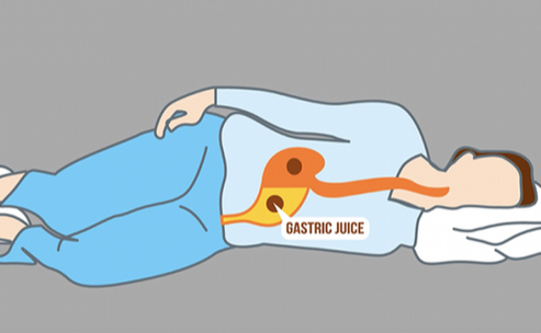 The Surprising Truth About Sleeping on Your Right Side The Surprising Truth About Sleeping on Your Right Side - featured image