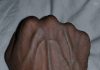 If you have visible veins, it means you are…. If you have visible veins, it means you are…. - featured image