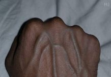 If you have visible veins, it means you are…. If you have visible veins, it means you are…. - featured image