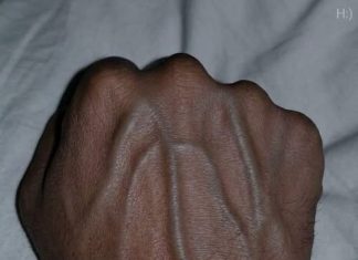If you have visible veins, it means you are…. If you have visible veins, it means you are…. - featured image